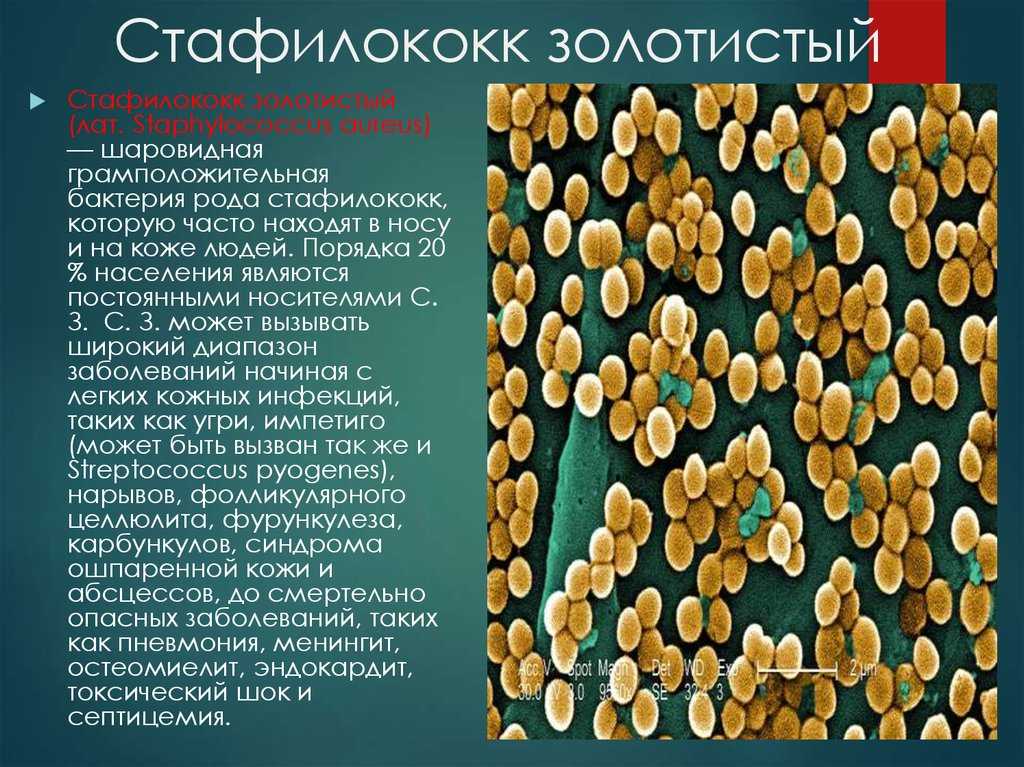 Стафилококк у взрослых и детей: гнойничковые заболевания кожи нужно лечить у врача!