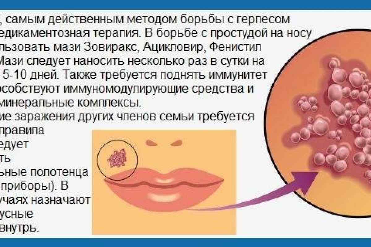 Признаки рецидивирующих вирусных инфекций – герпес, цмв, вэб, впч и др.