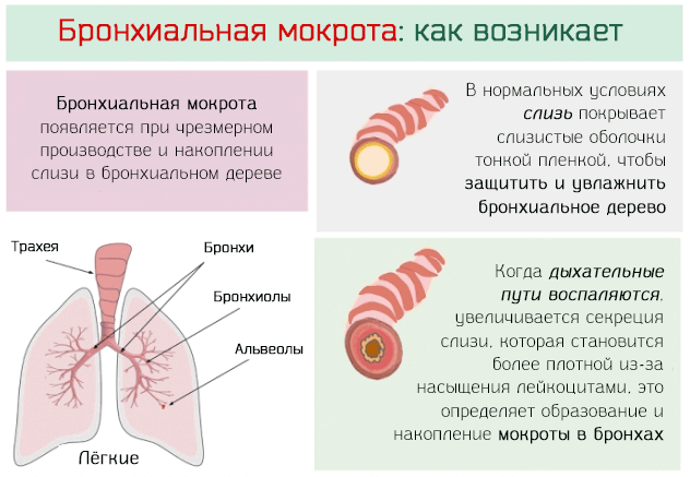 Бронхоспазм (спазм бронхов): причины и как развивается, симптоматика, помощь и как лечить