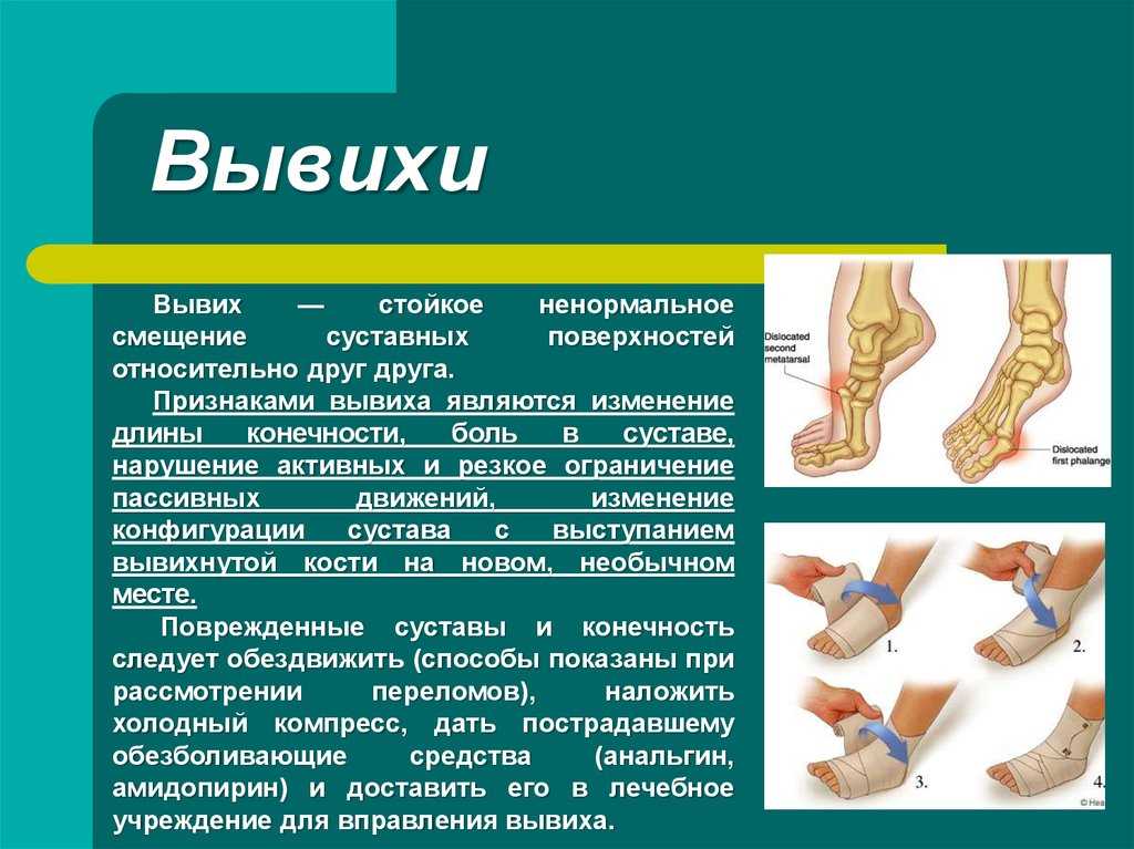 Как ушиб отличить от перелома