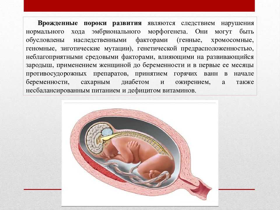 Пороки внутриутробного развития. патологии беременности: особенности распространенных патологических состояний