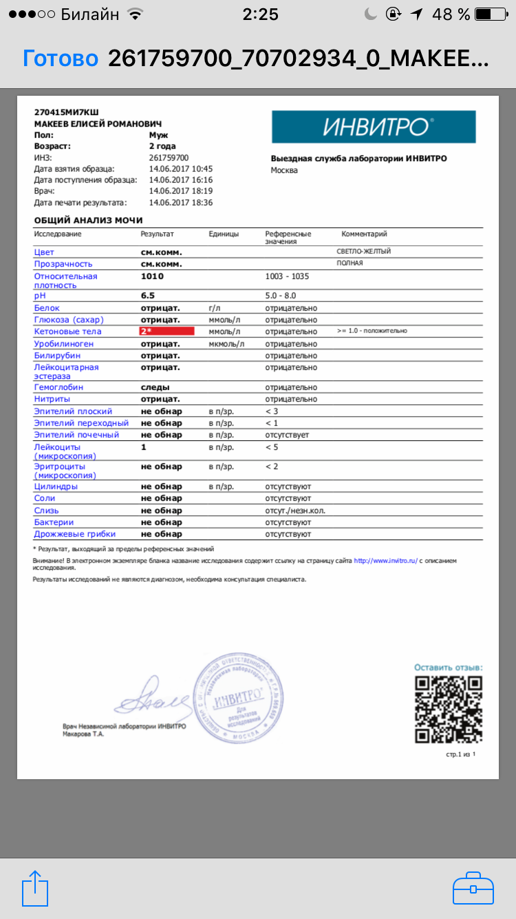 Кетоны в моче при беременности