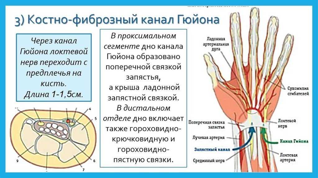 Перелом лучевой кости