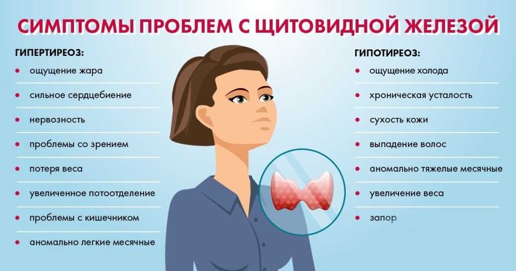 Почему ребенок потеет?
