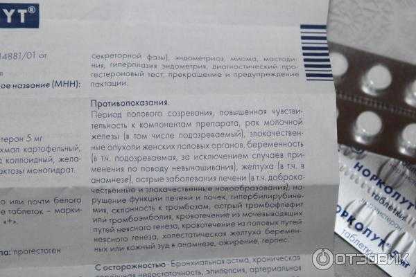 Норколут при эндометриозе: инструкция по применению и отзывы о лечении препаратом