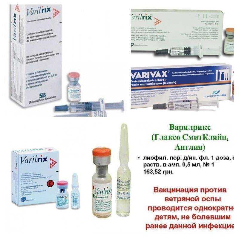 Прививка от ветрянки детям – кому она необходима?