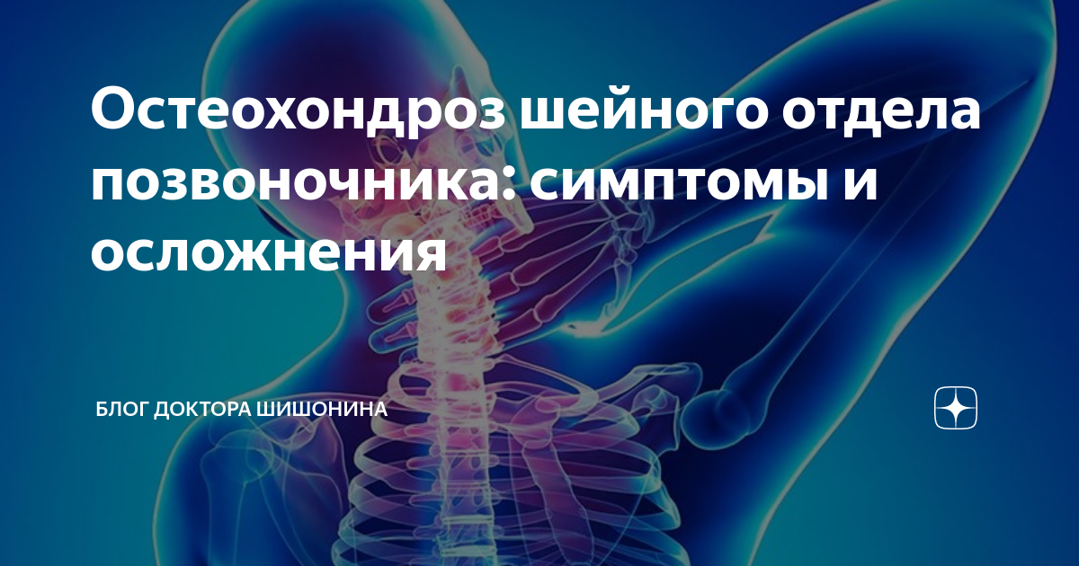 Помогает ли  Найз от головной боли  Можно ли пить таблетки  Найз NISE при головных болях  Головная боль зачастую застает врасплох, мешая активной
