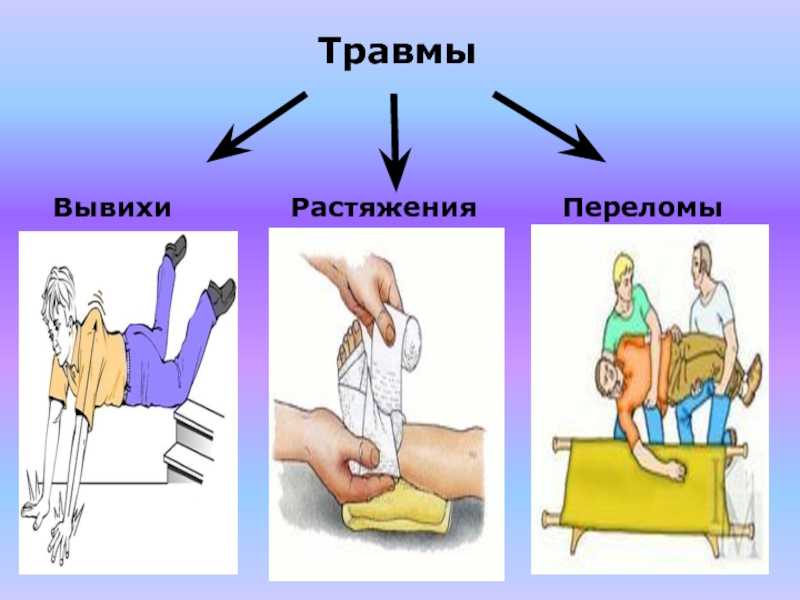 Как отличить вывих от перелома, ушиба и растяжения | irksportmol.ru