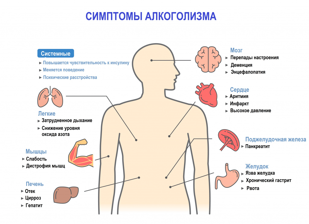 Что делать при отравлении алкоголем?