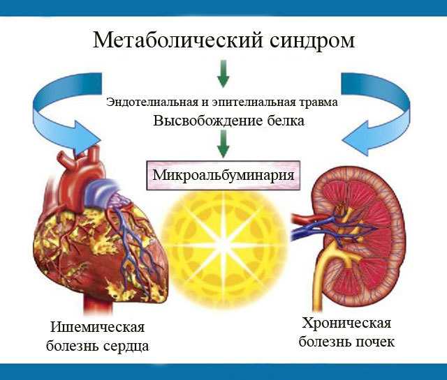 Высокое содержание микроальбумина в моче — ранний показатель нефропатии