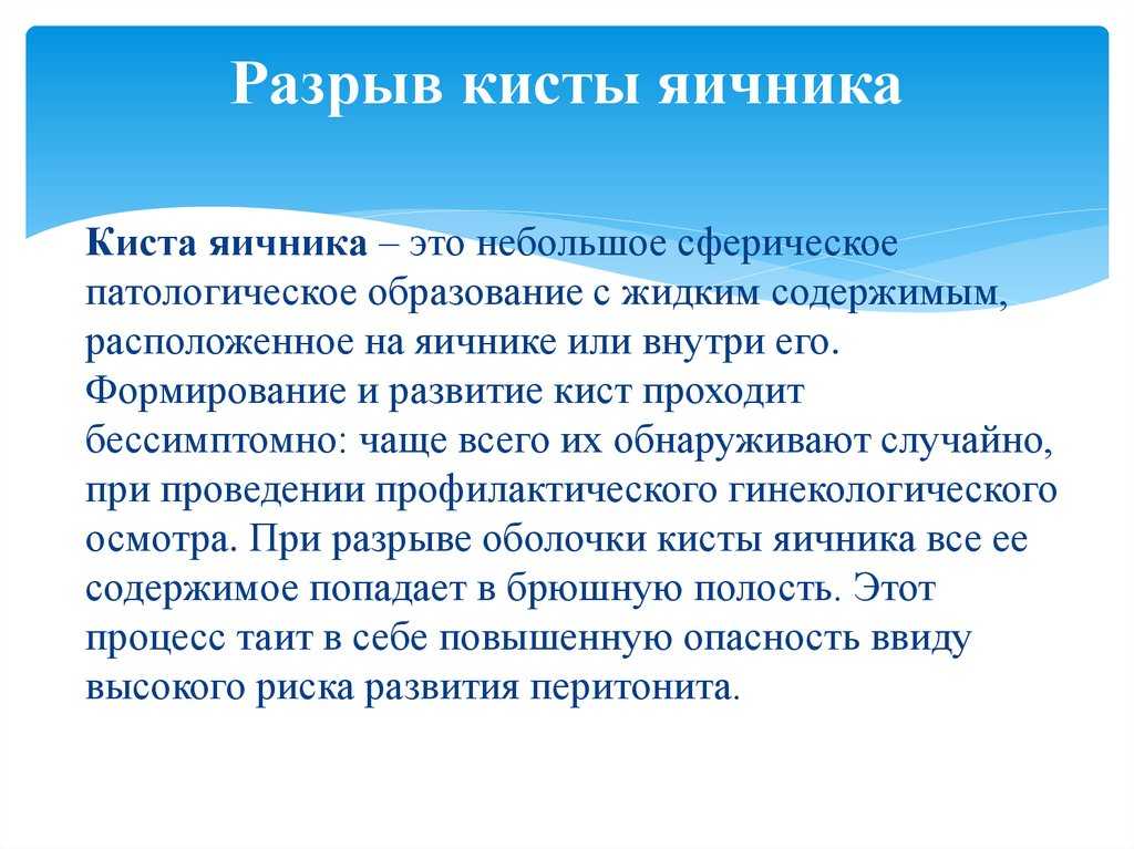 Киста яичника: большая обзорная статья