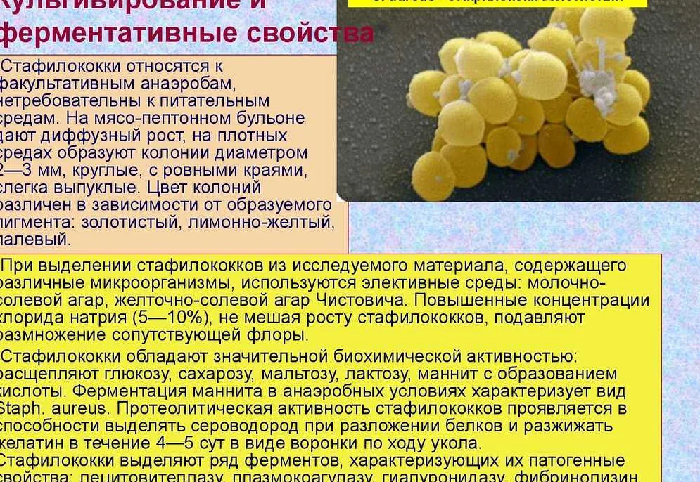 Золотистый стафилококк: причины, симптомы, лечение и профилактика | все о паразитах
