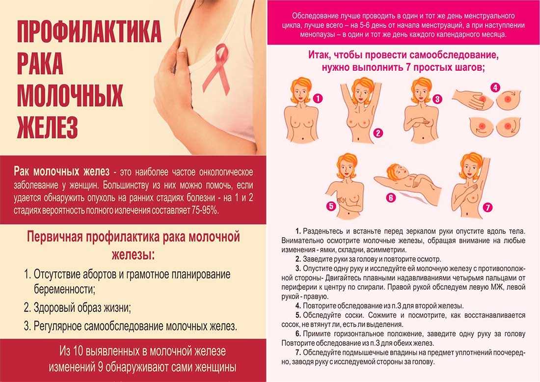 Узи молочных желез норма