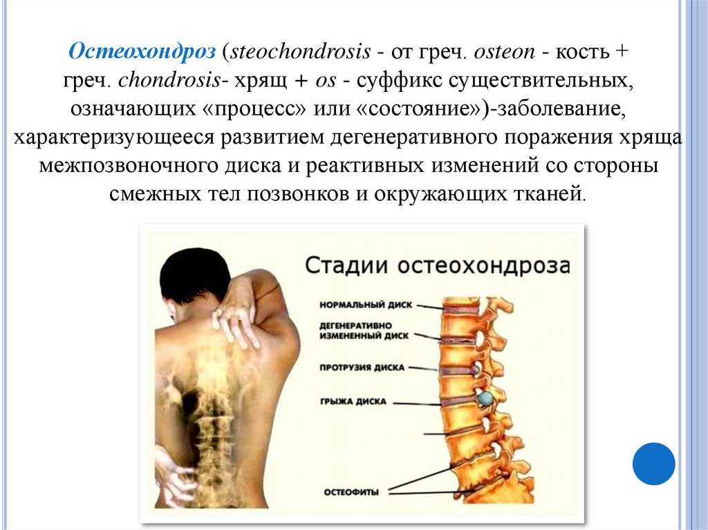 От чего принимают обезболивающие таблетки найз