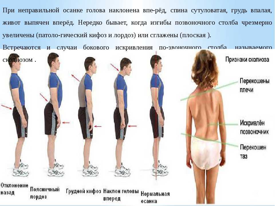 Болит спина и голова