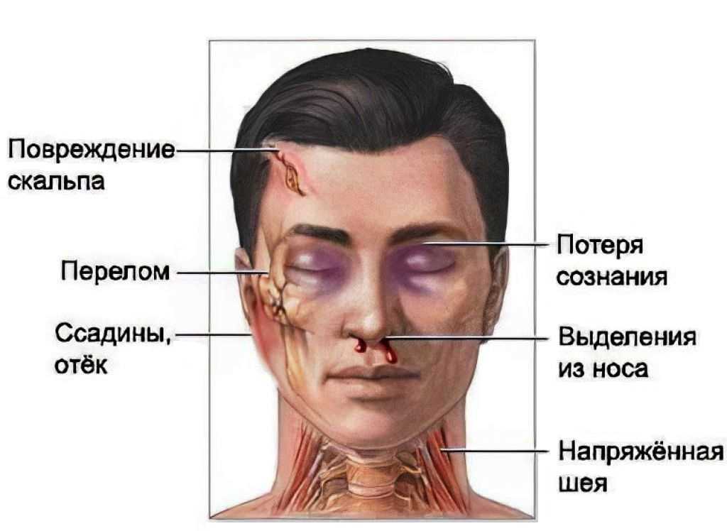 Черепно-мозговая травма: симптомы, классификация, первая помощь  О первой помощи при черепно-мозговой травме  Ч М Т  Головной мозг – центр управления всеми