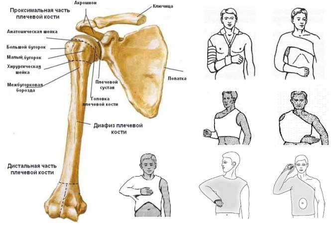 Перелом плеча (плечевой кости) - симптомы и лечение. журнал медикал