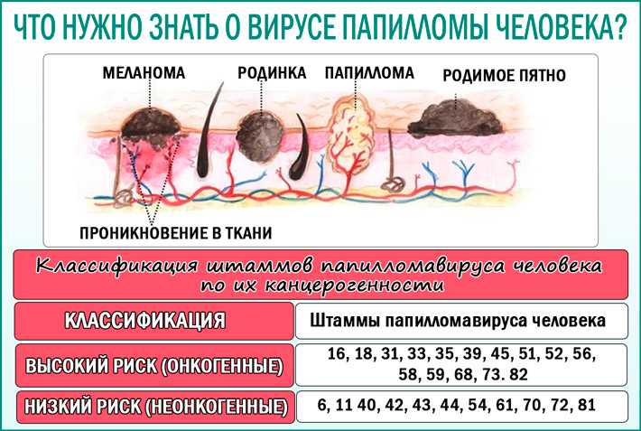 Чем опасен вирус папилломы человека? папилломавирус у мужчин и женщин