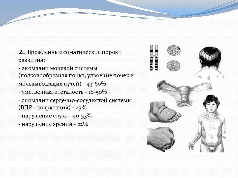 Врожденные пороки развития плода