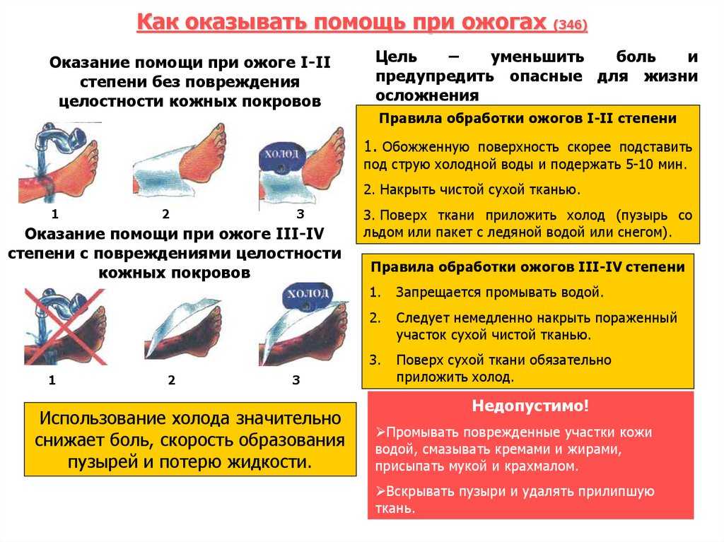 Виды ожогов в медицинской классификации