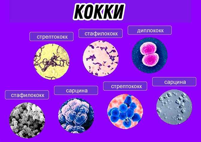 Диплококки в мазке у женщин: причины обнаружения