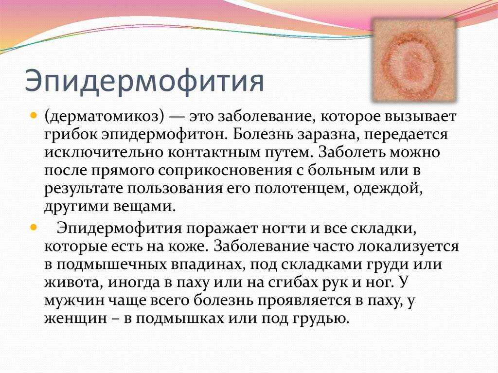 Паховой эпидермофитии способствуют повышенная температура воздуха, повышенная потливость и нарушение углеводного обмена Не удивительно, что это заболевание имеет большую распространенность в местах с теплым и влажным климатом