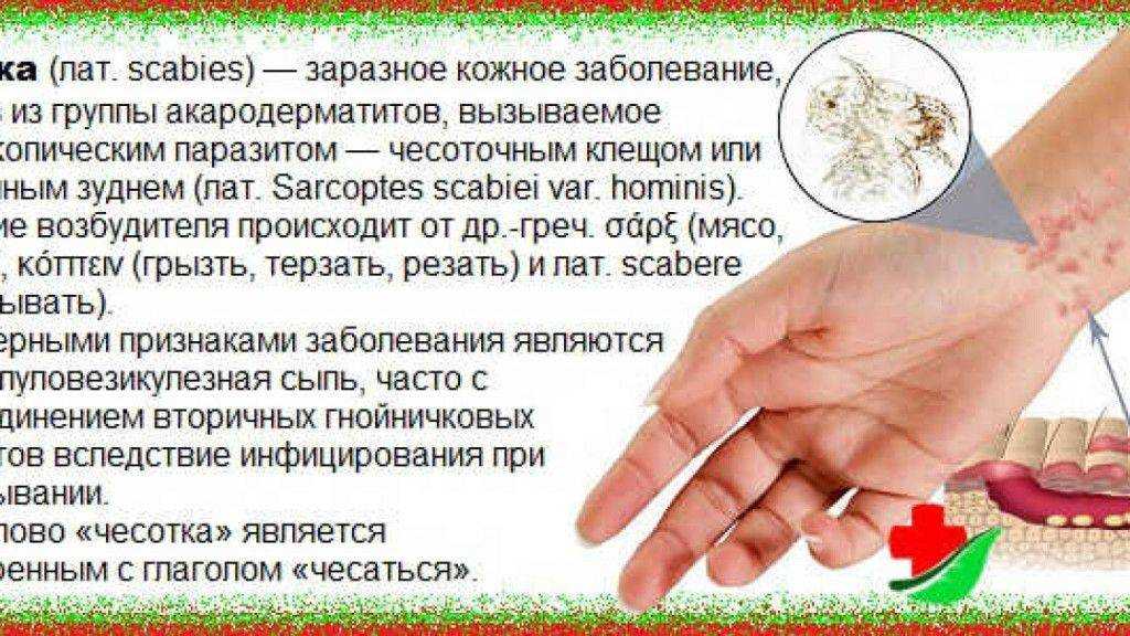 Профилактика при чесотке