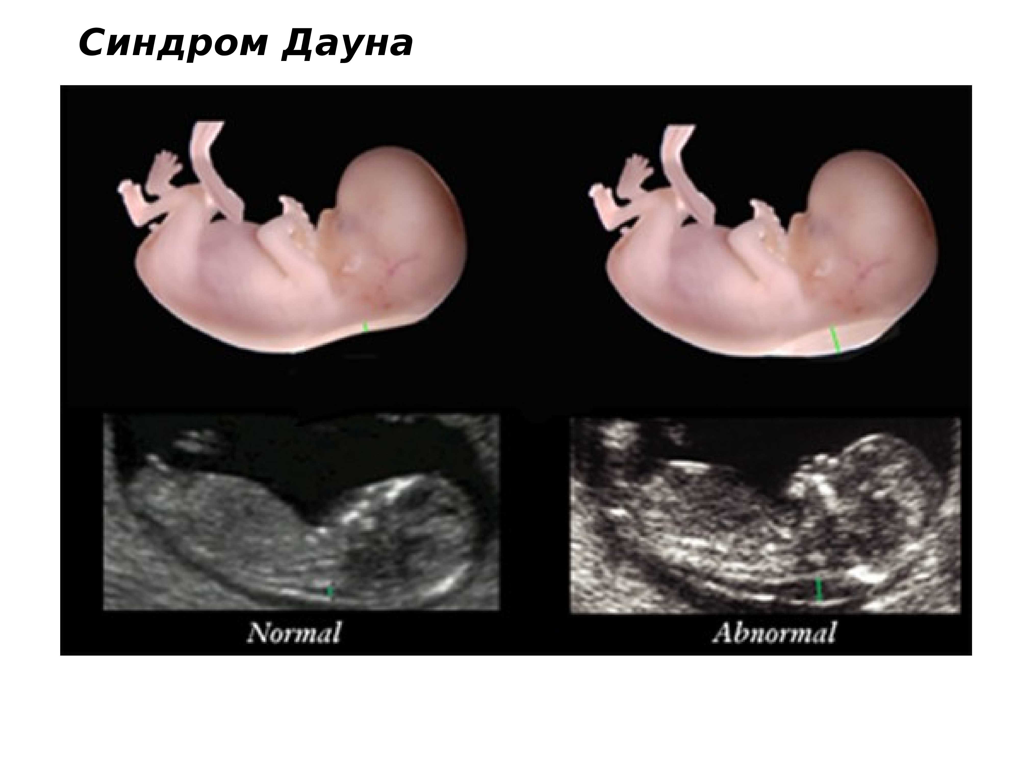 Будущая мама и ребенок на 12 неделе беременности
