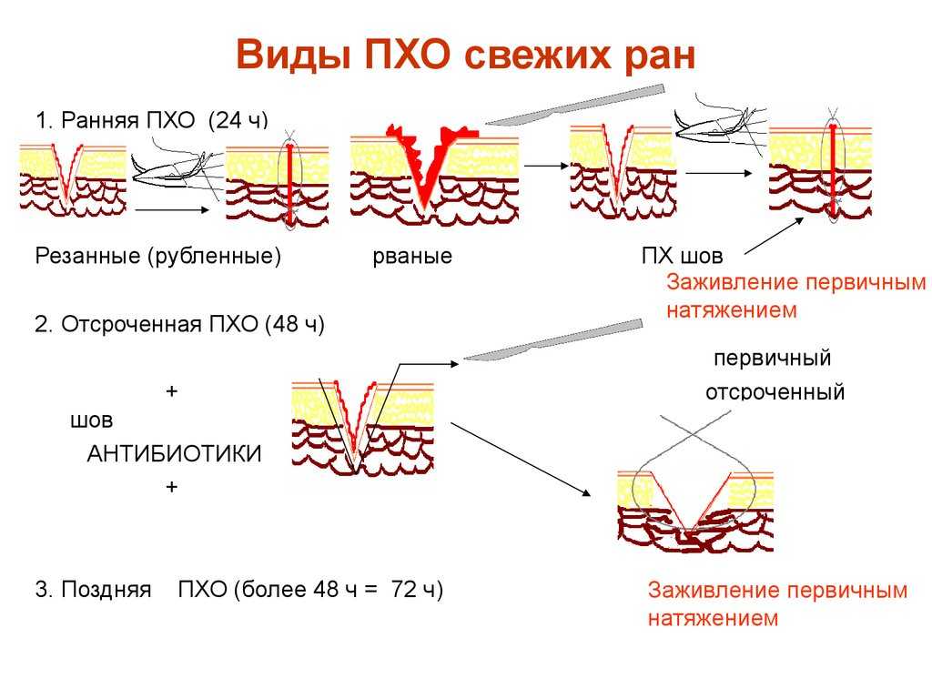 Заживление раны и оптимальный рубец. причины ран раневая хирургия