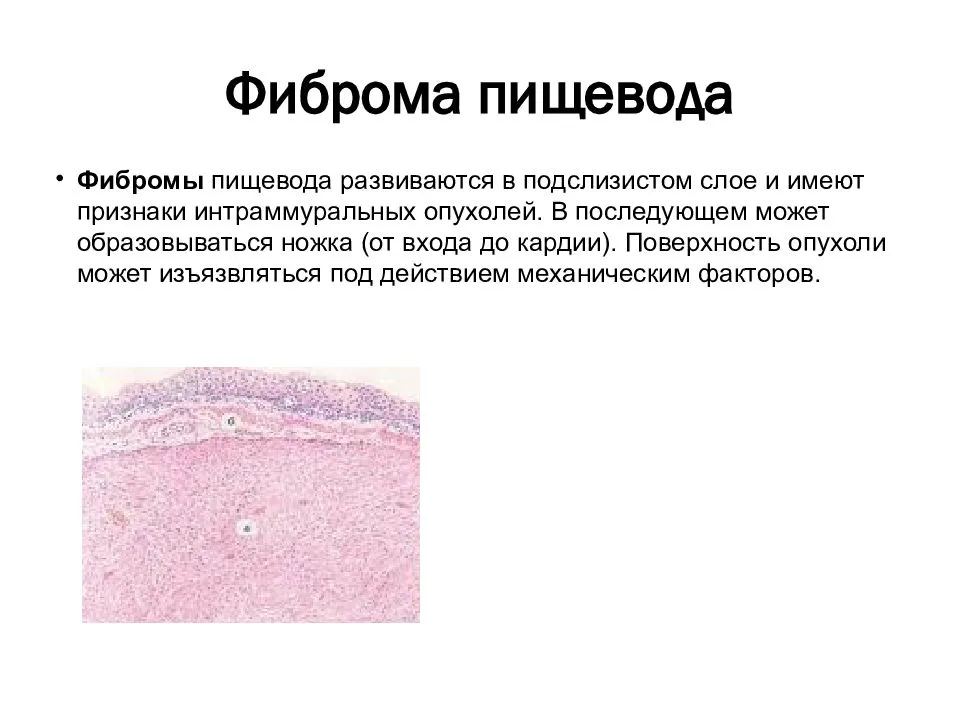 Чем отличается фиброма от папилломы - лечение