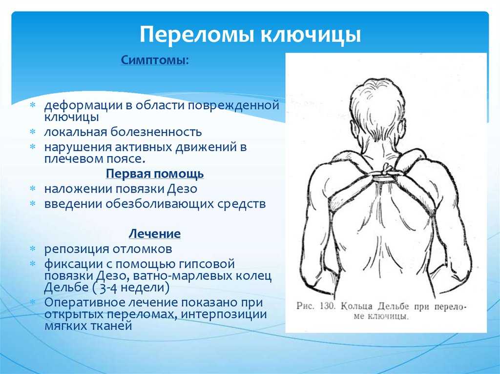 Ключица у человека: строение, функции, особенности, травмы и болезни