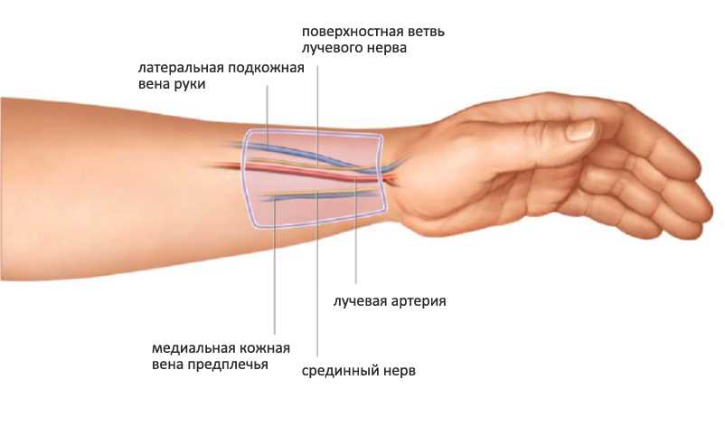 Шишки на венах после уколов