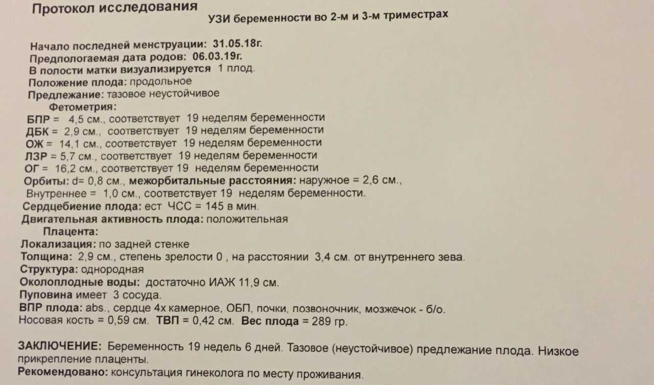 Узи при беременности. узи плода. выявление возможных пороков развития плода