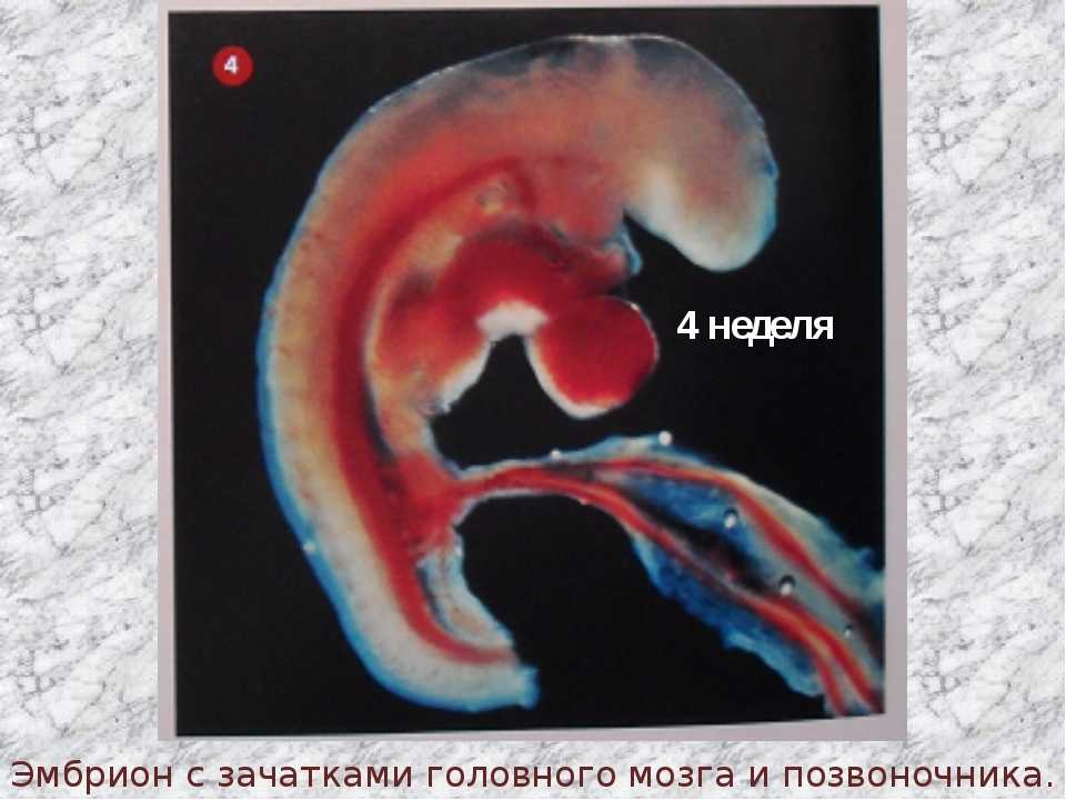 Что покажет узи матки на сроке в 4 недели беременности, какова норма исследования?