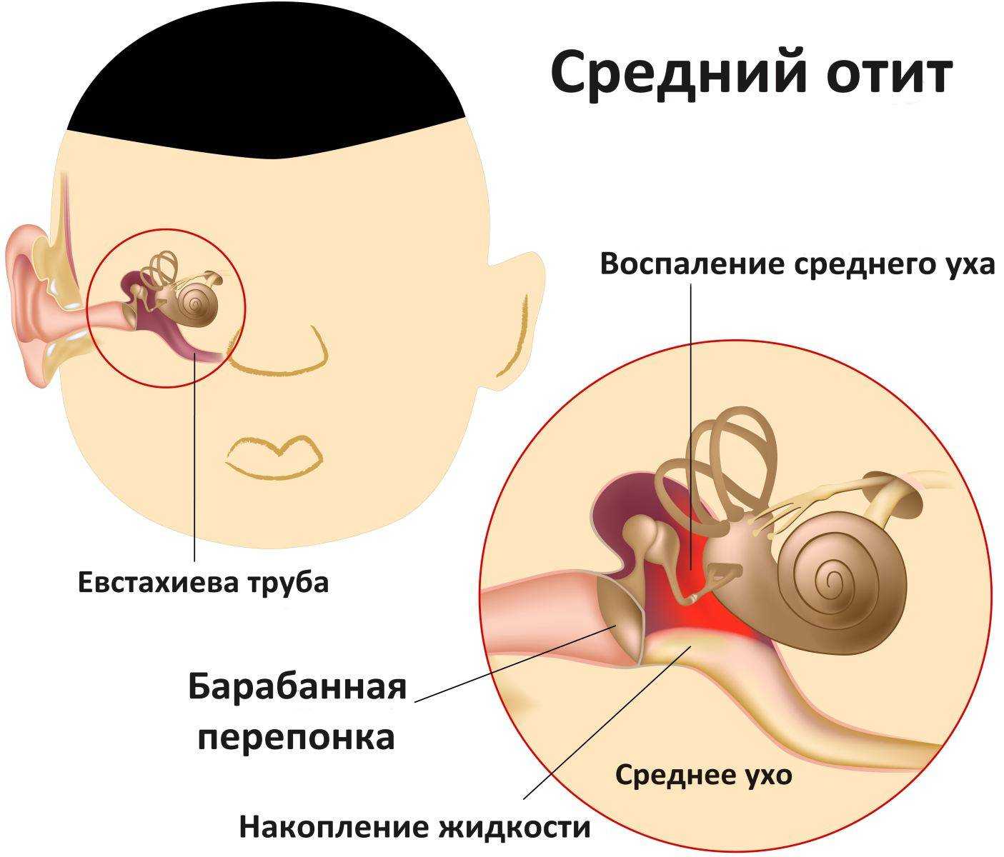 Головная боль за ушами
