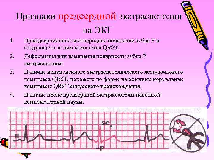 Нарушения сердечного ритма