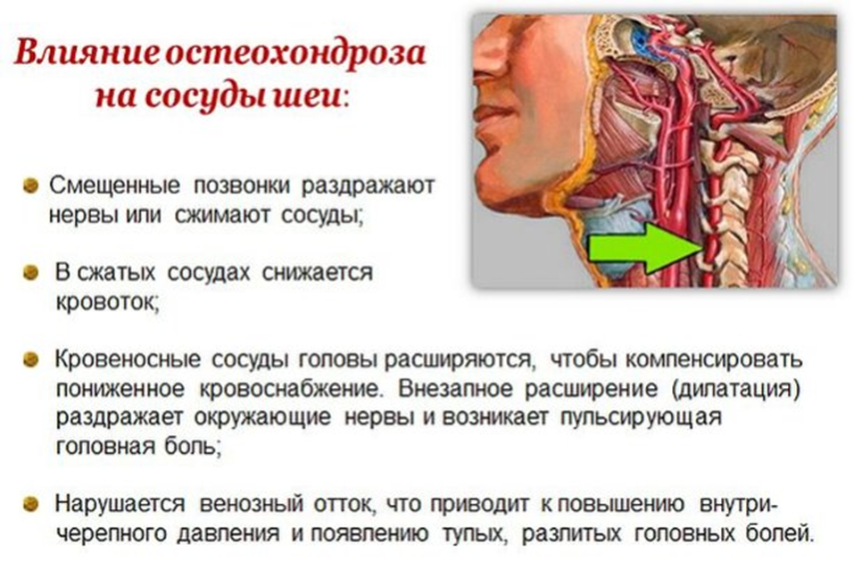 УЗИ БЦА позволяет оценить состояние сосудов шеи и головы, помогает выявить на ранней стадии различные нарушения в сосудистой системе: атеросклероз, стеноз, тромбоз, аневризма, аномалии строения и другие