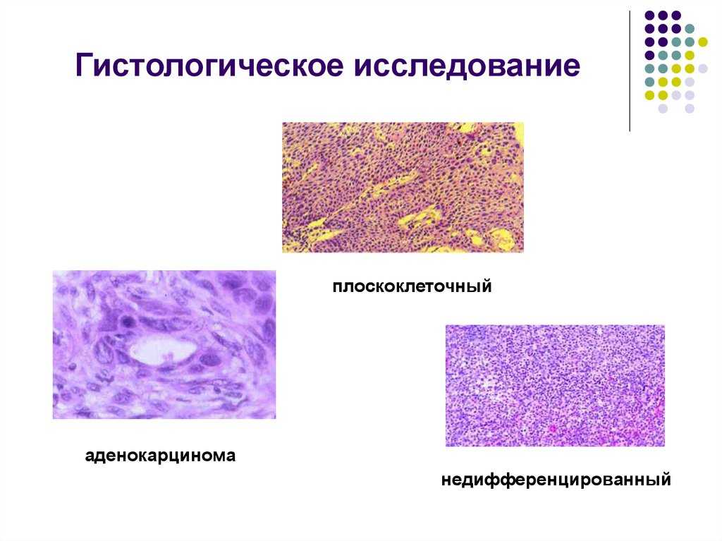 Показывает ли гистология инфекцию