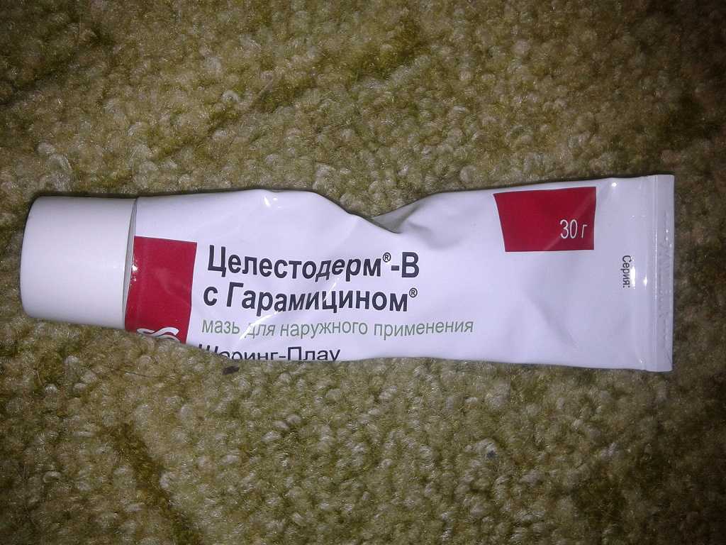 Мазь целестодерм: показания к применению