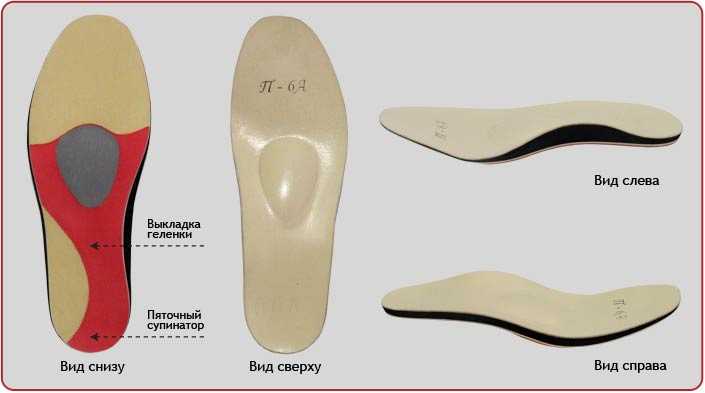 Как выбрать ортопедические стельки при поперечном плоскостопии?