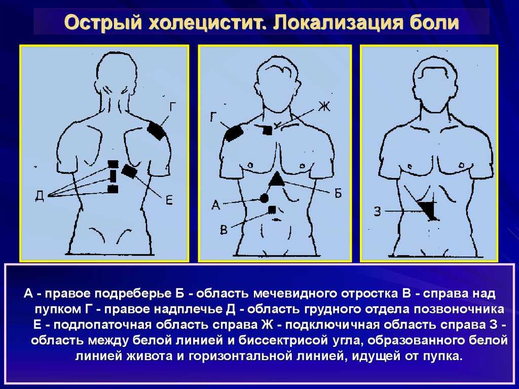 Как вылечить мечевидный отросток
