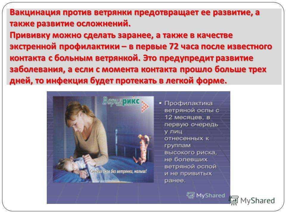 Нужна ли вакцинация от ветрянки детям