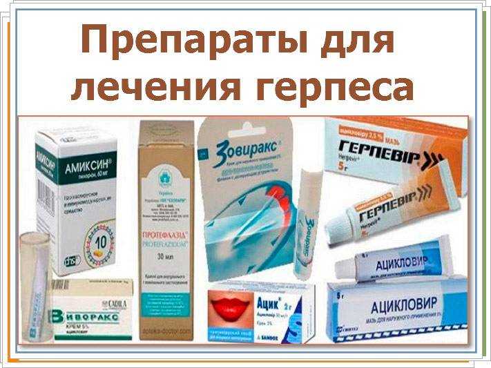Генитальный герпес у женщин: как выглядит, признаки, 3 способа лечения