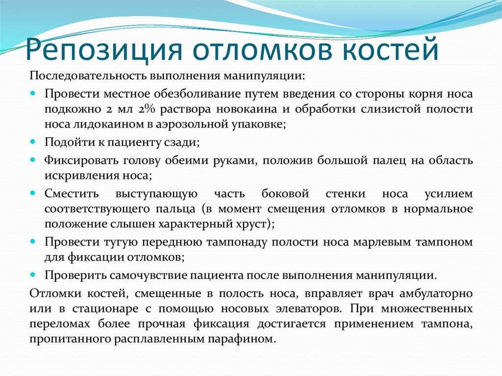 Как вправить нос в домашних условиях и можно ли это делать