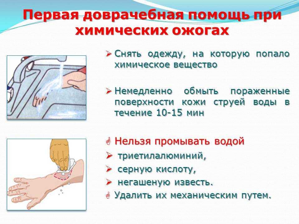 Мази и кремы от ожогов: как выбрать эффективное средство