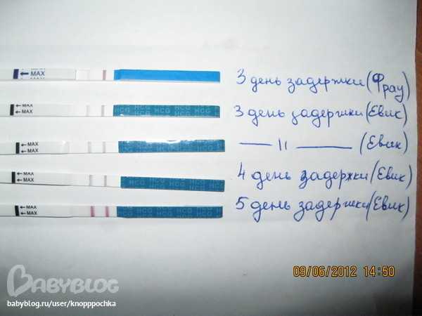 Как отличить обильные месячные от кровотечения - ответы врача
