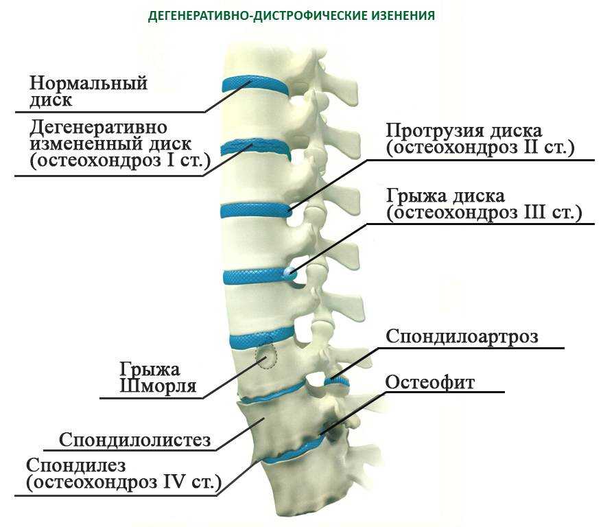Найз повышает или снижает давление