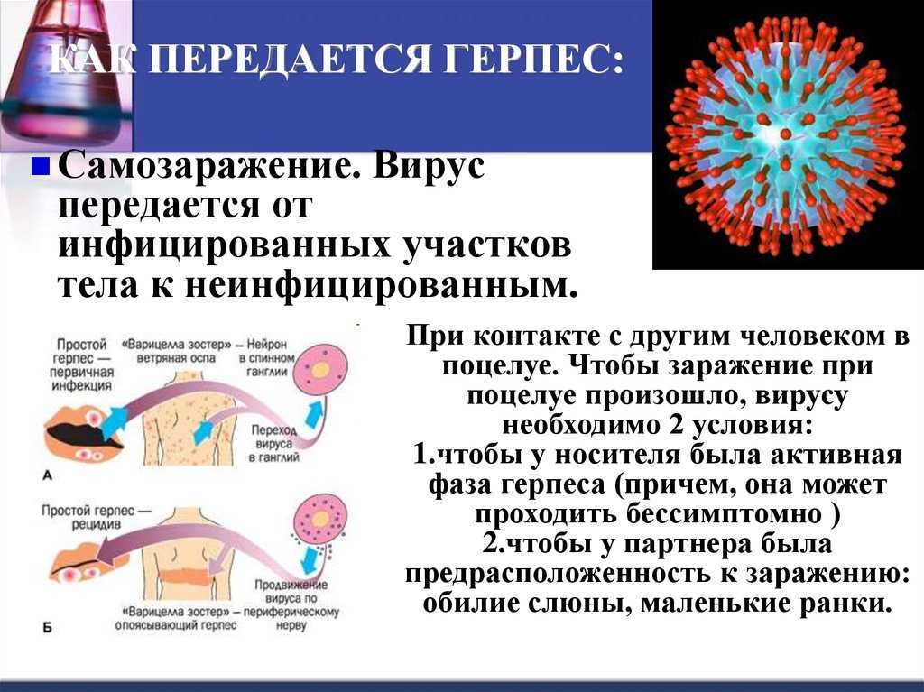 Как передается герпес на губах, заразен ли он через поцелуй?