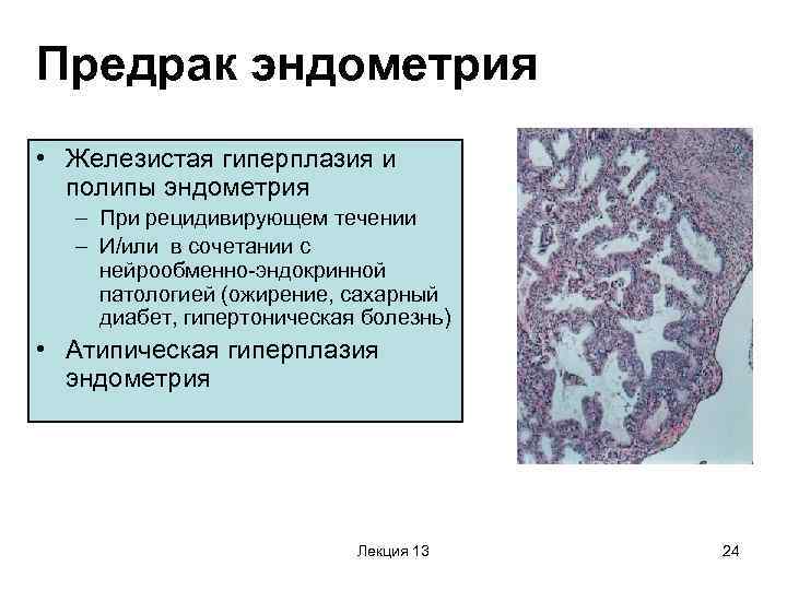 Гиперплазия желудка: виды, диагностика и лечение