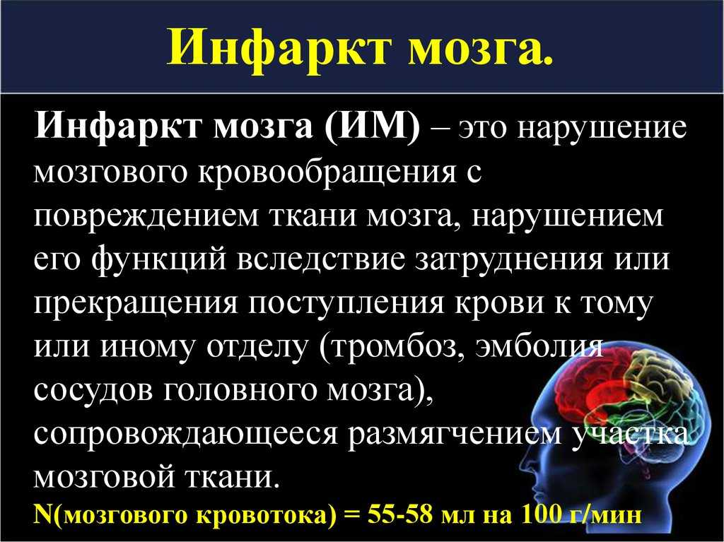 Инсульт - острое нарушение мозгового кровообращения - неврология - статьи - российско-финский медицинский центр terve в санкт-петербурге